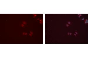 ABIN6277347 staining Hela cells by IF/ICC. (CPT2 Antikörper  (Internal Region))