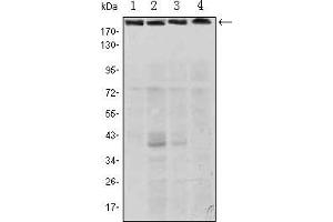 Western blot analysis using RICTOR mouse mAb against Hela (1), PANC-1 (2), MOLT4 (3), and HepG2 (4) cell lysate. (RICTOR Antikörper)
