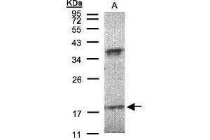 WB Image Sample(30 μg of whole cell lysate) A:H1299 12% SDS PAGE antibody diluted at 1:200 (IFNA6 Antikörper  (C-Term))