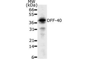 Western Blotting (WB) image for anti-DNA Fragmentation Factor, 40kDa, beta Polypeptide (Caspase-Activated DNase) (DFFB) (AA 205-222) antibody (ABIN208001) (DFFB Antikörper  (AA 205-222))