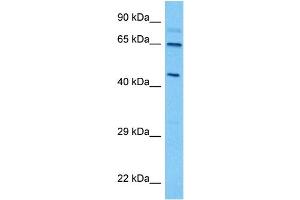 Host:  Mouse  Target Name:  THRA  Sample Tissue:  Mouse Spleen  Antibody Dilution:  1ug/ml (THRA Antikörper  (Middle Region))