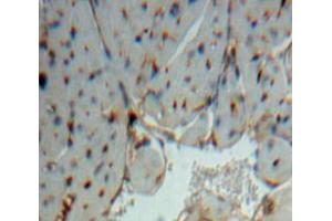 Used in DAB staining on fromalin fixed paraffin-embedded Heart tissue (NOSTRIN Antikörper  (AA 6-245))