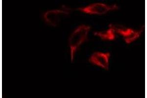 ABIN6275217 staining  Hela cells by IF/ICC. (Macrophage Mannose Receptor 1 Antikörper  (Internal Region))