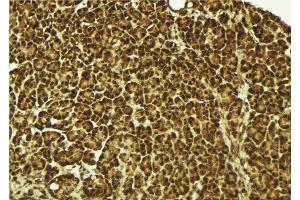 ABIN6279483 at 1/100 staining Mouse pancreas tissue by IHC-P.