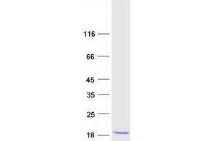 Validation with Western Blot (Diazepam Binding Inhibitor Protein (DBI) (Transcript Variant 1) (Myc-DYKDDDDK Tag))