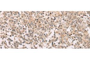 Immunohistochemistry of paraffin-embedded Human tonsil tissue using M1AP Polyclonal Antibody at dilution of 1:80(x200) (Meiosis 1 Associated Protein (M1AP) Antikörper)