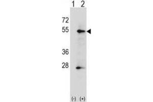Western Blotting (WB) image for anti-Placental Alkaline Phosphatase (ALPP) antibody (ABIN2998362) (PLAP Antikörper)