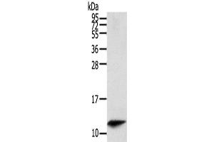 Western Blot analysis of Mouse spleen tissue using PBOV1 Polyclonal Antibody at dilution of 1/200 (PBOV1 Antikörper)