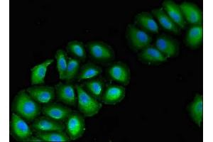 Immunofluorescent analysis of A549 cells using ABIN7175353 at dilution of 1:100 and Alexa Fluor 488-congugated AffiniPure Goat Anti-Rabbit IgG(H+L) (VPS39 Antikörper  (AA 263-490))