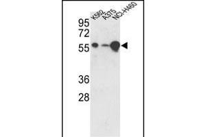 Western blot analysis of hUSP3- (ABIN388881 and ABIN2839174) in K562, , NCI- cell line lysates (35 μg/lane). (USP3 Antikörper  (C-Term))