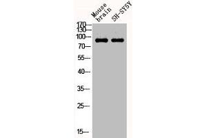 Western Blot analysis of MOUSE-BRAIN SH-SY5Y cells using Phospho-Stat1 (Y701) Polyclonal Antibody (STAT1 Antikörper  (pTyr701))
