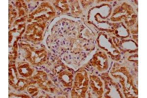 IHC image of ABIN7139867 diluted at 1:100 and staining in paraffin-embedded human kidney tissue performed on a Leica BondTM system.