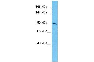 Western Blotting (WB) image for anti-Potassium Voltage-Gated Channel, Shab-Related Subfamily, Member 1 (KCNB1) (C-Term) antibody (ABIN5515521)