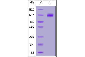 Fed Human B7-H3 (4Ig), His Tag on  under reducing (R) condition.