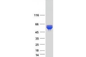 Western Blotting (WB) image for Caspase Recruitment Domain Family, Member 9 (CARD9) (Transcript Variant 2) protein (Myc-DYKDDDDK Tag) (ABIN2713169)