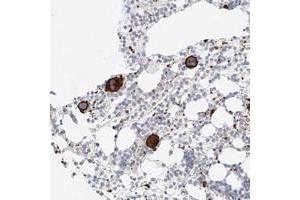 Immunohistochemical staining of human bone marrow with LOC389813 polyclonal antibody  shows strong cytoplasmic and membrane positivity in bone marrow poietic cells at 1:50-1:200 dilution.