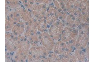 Detection of GHR in Rat Kidney Tissue using Polyclonal Antibody to Growth Hormone Receptor (GHR) (Growth Hormone Receptor Antikörper  (AA 353-588))