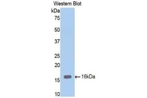 Detection of Recombinant ENG, Mouse using Polyclonal Antibody to Endoglin (ENG) (Endoglin Antikörper  (AA 336-450))