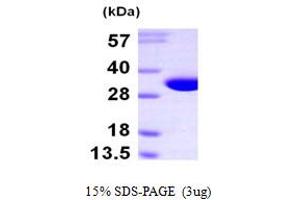 Nitrilase Family, Member 2 (NIT2) (AA 1-276) protein (His tag)