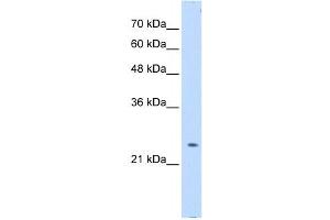 PTPN2 antibody used at 0. (PTPN2 Antikörper  (Middle Region))