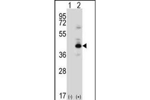 Western blot analysis of PRKACB (arrow) using rabbit polyclonal PRKACB Antibody (K29) (ABIN6243845 and ABIN6578978).