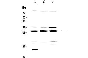 Western blot analysis of TPMT using anti-TPMT antibody . (TPMT Antikörper  (AA 1-245))