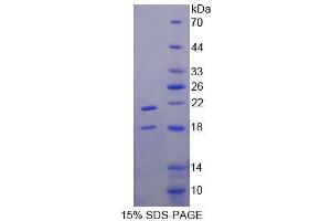 SDS-PAGE analysis of Human TRPV6 Protein. (TRPV6 Protein)