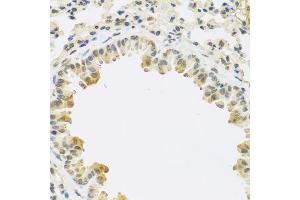Immunohistochemistry of paraffin-embedded mouse lung using TGFB3 antibody (ABIN5974864) at dilution of 1/100 (40x lens). (TGFB3 Antikörper)