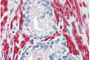 Anti-TRPM8 antibody  ABIN960829 IHC staining of human prostate. (TRPM8 Antikörper  (N-Term))