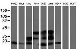 Image no. 4 for anti-ADP-Ribosylation Factor-Like 2 Binding Protein (ARL2BP) antibody (ABIN1496716) (ARL2BP Antikörper)