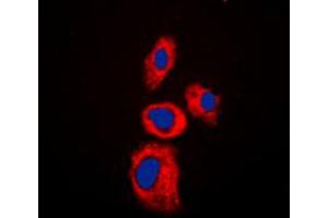Immunofluorescent analysis of AIM2 staining in Jurkat cells. (AIM2 Antikörper  (Center))