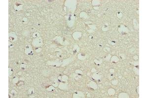 Immunohistochemistry of paraffin-embedded human brain tissue using ABIN7172953 at dilution of 1:100 (TMCC1 Antikörper  (AA 51-300))