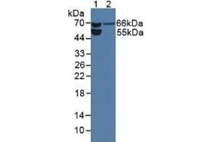 Western blot analysis of (1) Rat Serum and (2) Rat Kidney Tissue. (Endoglin Antikörper  (AA 26-136))