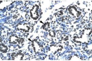 Human Lung; CLDN17 antibody - middle region in Human Lung cells using Immunohistochemistry (Claudin 17 Antikörper  (Middle Region))