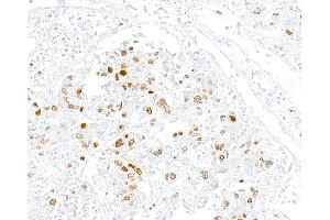 Immunohistochemistry (IHC) image for anti-Topo IIalpha (AA 650-700) antibody (ABIN7795794)