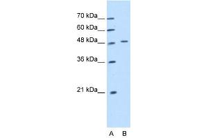 WB Suggested Anti-KRT20 Antibody Titration:  1. (KRT20 Antikörper  (Middle Region))