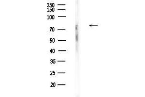 Western blot analysis of lysates from Mouse testis, using Phospho-PKC theta (Ser676) Antibody at 1/1000 dilution.