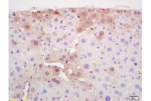 Formalin-fixed and paraffin embedded mouse liver labeled with Rabbit Anti CPT2 Polyclonal Antibody, Unconjugated (ABIN708881) at 1:200 followed by conjugation to the secondary antibody and DAB staining (CPT2 Antikörper  (AA 401-500))