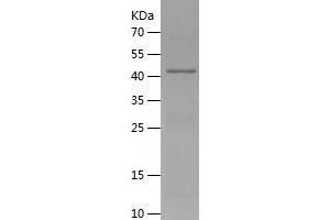 ADRP Protein (AA 82-311) (His-IF2DI Tag)