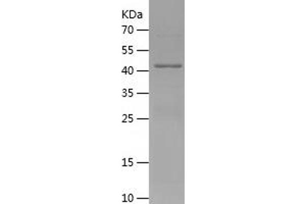 ADRP Protein (AA 82-311) (His-IF2DI Tag)