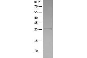 Western Blotting (WB) image for ATG3 Autophagy Related 3 (ATG3) (AA 1-287) protein (His tag) (ABIN7121920)