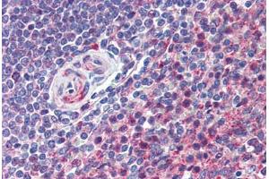 Human Spleen (formalin-fixed, paraffin-embedded) stained with CD97 antibody ABIN292888 at 10 ug/ml followed by biotinylated goat anti-rabbit IgG secondary antibody ABIN481713, alkaline phosphatase-streptavidin and chromogen. (CD97 Antikörper  (AA 220-270))