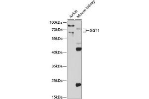 Western blot analysis of extracts of various cell lines, using GGT1 antibody (ABIN3022526, ABIN3022527, ABIN3022528 and ABIN6218881) at 1:1000 dilution. (GGT1 Antikörper  (AA 370-569))