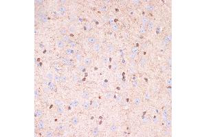 Immunohistochemistry of paraffin-embedded mouse brain using Gelsolin Rabbit mAb (ABIN7267364) at dilution of 1:100 (40x lens). (Gelsolin Antikörper)