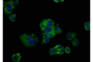 Immunofluorescence staining of MCF-7 cells with ABIN7153155 at 1:133, counter-stained with DAPI. (FREM2 Antikörper  (AA 1986-2127))