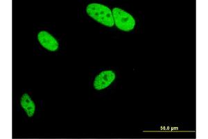 Immunofluorescence of monoclonal antibody to MED9 on HeLa cell. (MED9 Antikörper  (AA 1-146))