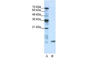 WB Suggested Anti-C14ORF156  Antibody Titration: 0. (SLIRP Antikörper  (N-Term))