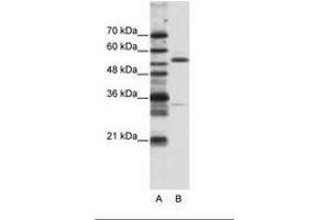 Image no. 1 for anti-Zinc Finger Protein 655 (ZNF655) (N-Term) antibody (ABIN203180) (ZNF655 Antikörper  (N-Term))