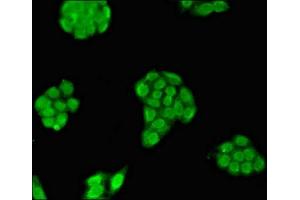 Immunofluorescent analysis of PC-3 cells using ABIN7159078 at dilution of 1:100 and Alexa Fluor 488-congugated AffiniPure Goat Anti-Rabbit IgG(H+L) (MXI1 Antikörper  (AA 75-173))