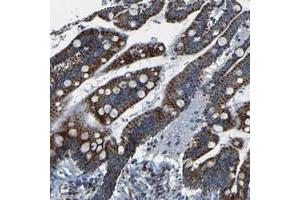 Immunohistochemical staining of human colon with WSCD2 polyclonal antibody  shows strong cytoplasmic positivity, with a granular pattern, in glandular cells. (WSCD2 Antikörper)